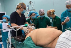 肥胖的危害高清短视频